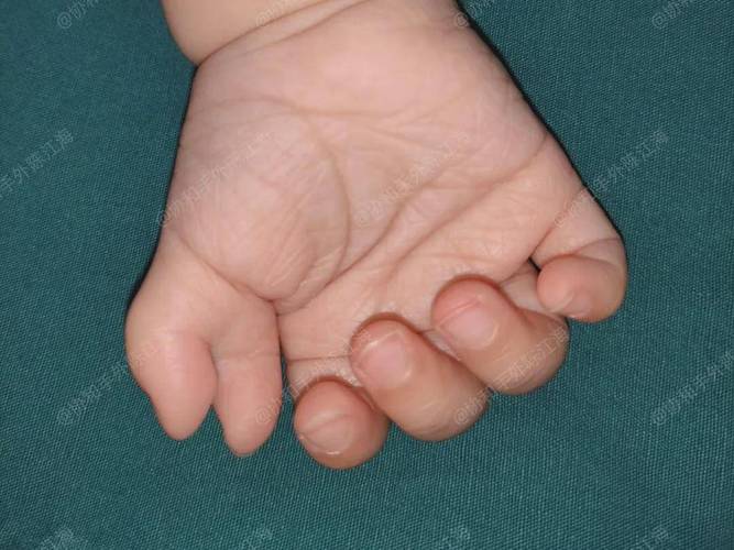 感情线分叉_感情线分叉再分叉_分叉线是什么